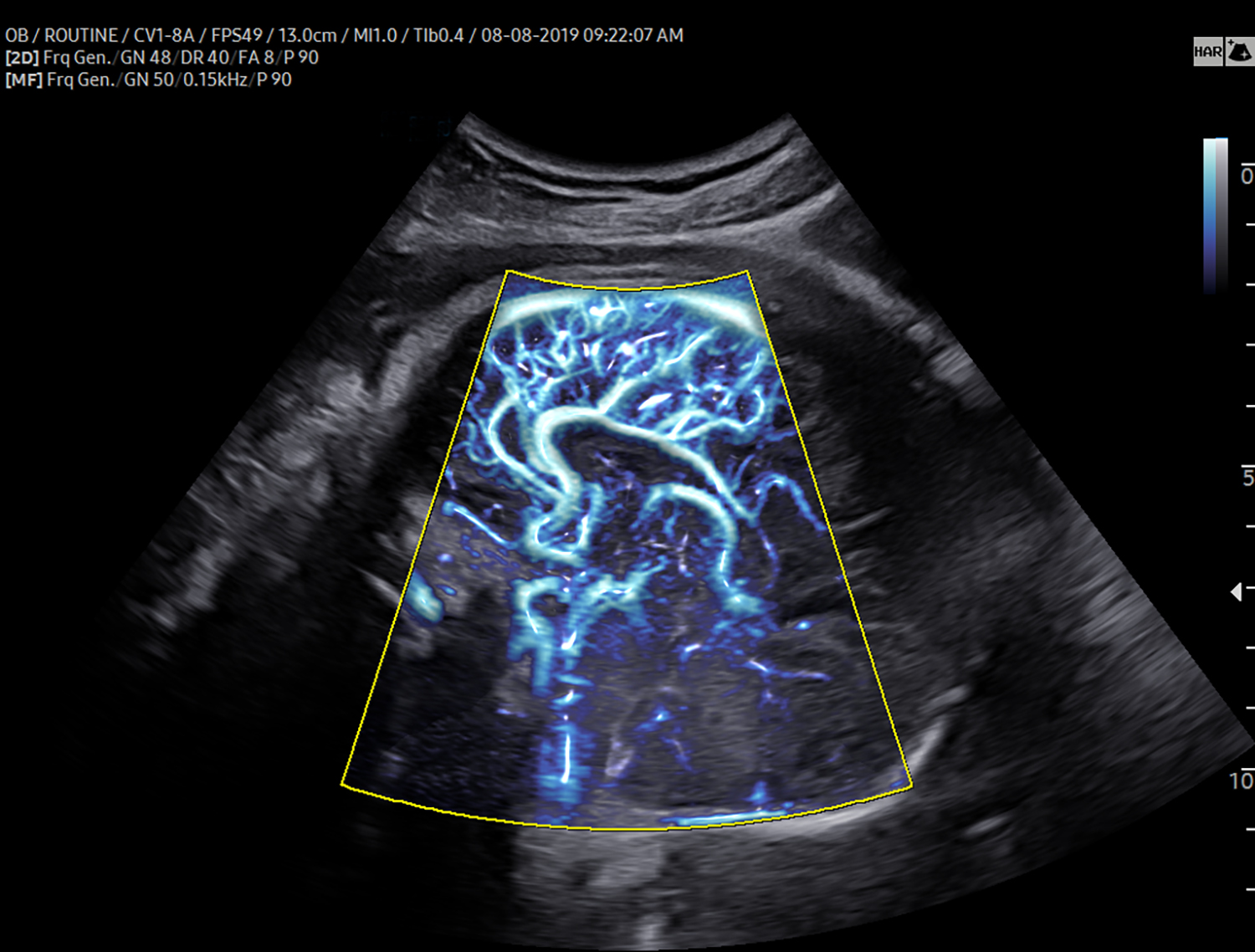 Brain Vasculature with MV Flow-1