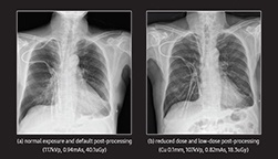 GC85 Low Dose White Paper_Thumbnail