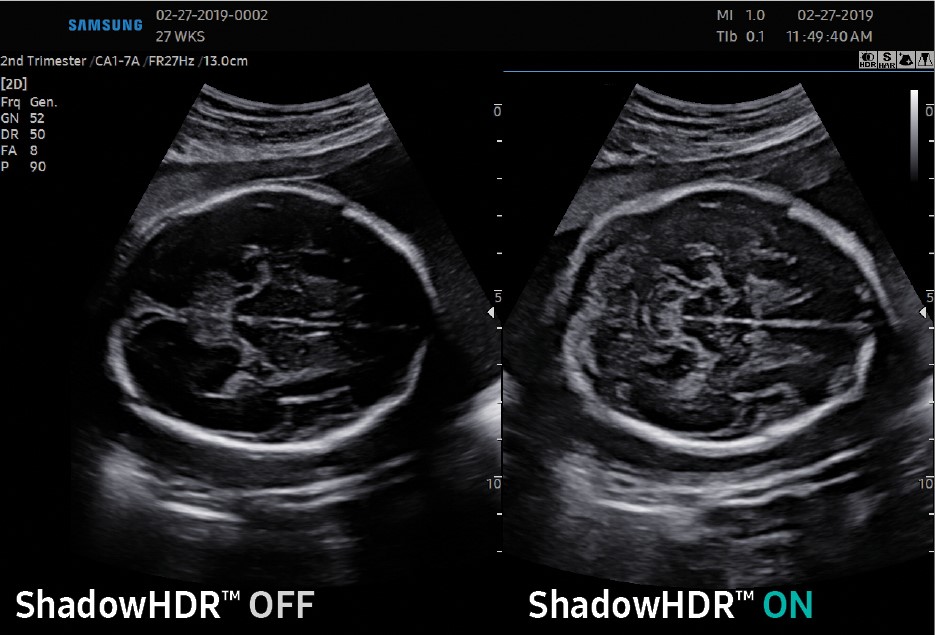 ShadowHDR Off On