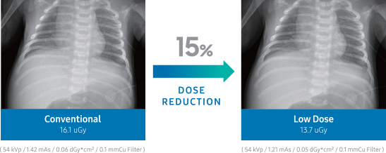 conventional pediatric chest scan